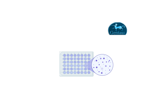 [COV19M.CE] ELISA Kits IgM 