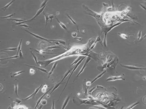 [GEN300701MA] Human Dental Follicle stem Cells (hDFSC) Cells